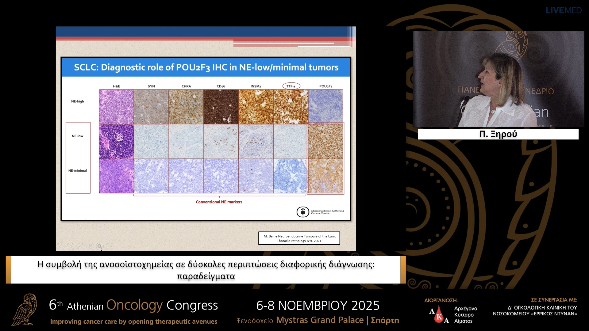 05 Π. Ξηρού - Η συμβολή της ανοσοϊστοχημείας σε δύσκολες περιπτώσεις διαφορικής διάγνωσης: παραδείγματα.