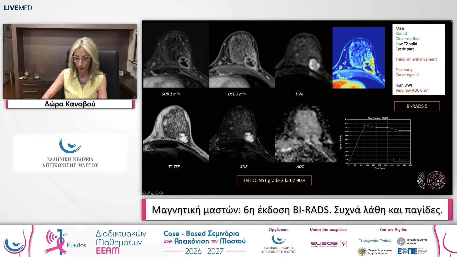 05 Δώρα Καναβού - Μαγνητική μαστών: 6η έκδοση BI-RADS. Συχνά λάθη και παγίδες.