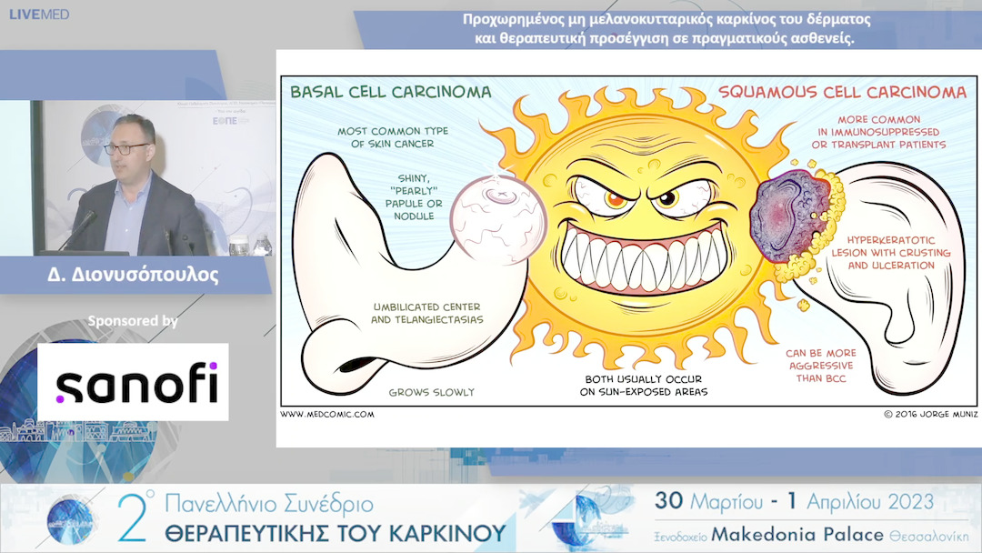 18 Δ. Διονυσόπουλος - Προχωρημένος μη μελανοκυτταρικός καρκίνος του δέρματος και θεραπευτική προσέγγιση σε πραγματικούς ασθενείς.