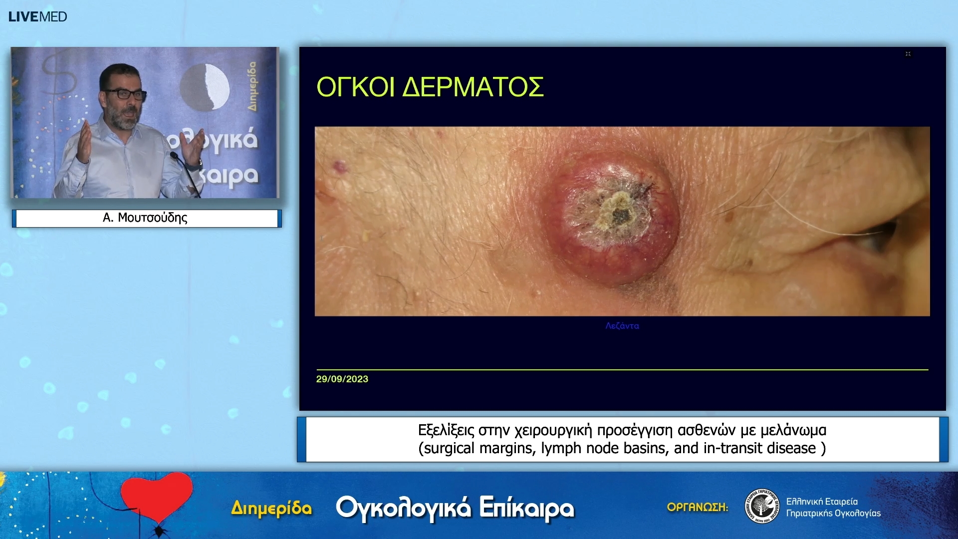 07 Α. Μουτσούδης - Εξελίξεις στην χειρουργική προσέγγιση ασθενών με μελάνωμα (surgical margins, lymph node basins, and in-transit disease ) 