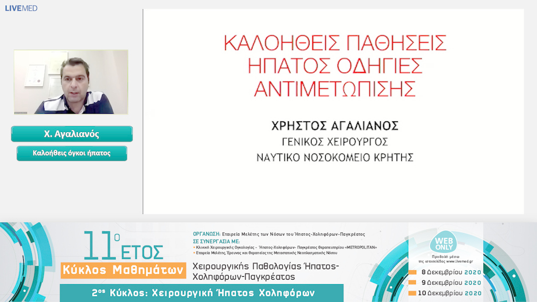 05 Χ. Αγαλιανός - Καλοήθεις όγκοι ήπατος