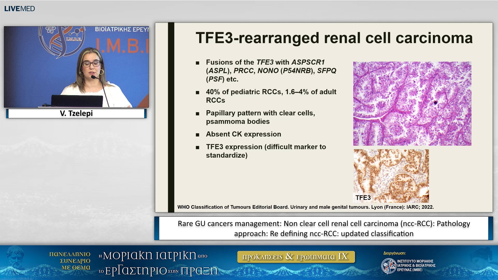 78 V. Tzelepi - Pathology approach: Re defining ncc-RCC: updated classification 