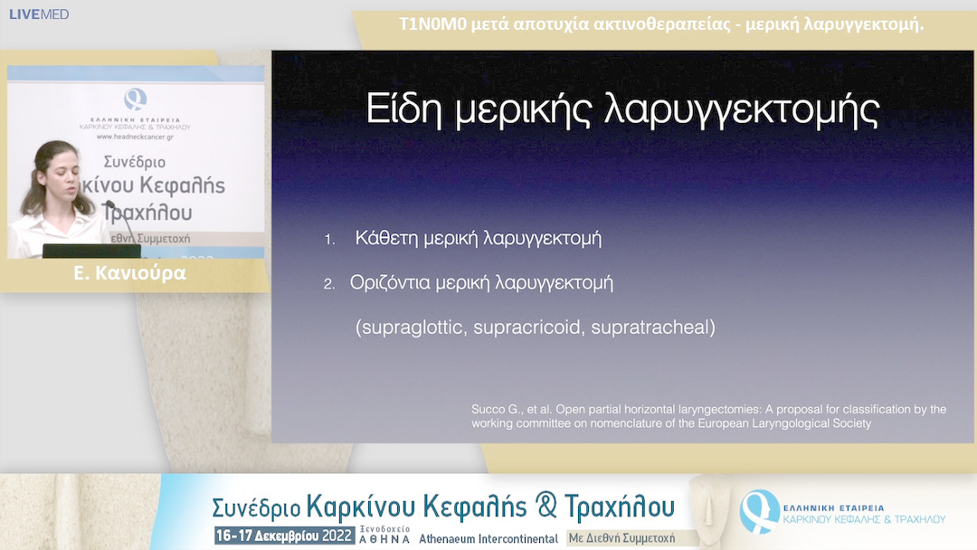 19 Ε. Κανιούρα - Τ1Ν0Μ0 μετά αποτυχία ακτινοθεραπείας - μερική λαρυγγεκτομή.