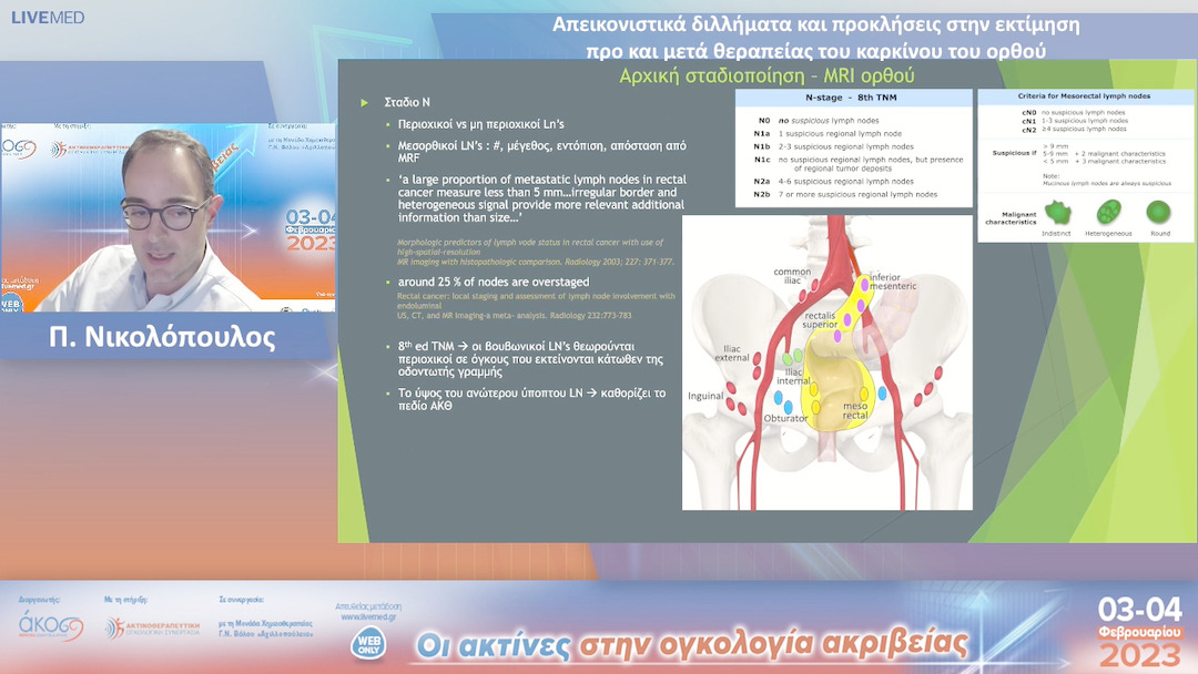 47 Π. Νικολόπουλος - Απεικονιστικά διλλήματα και προκλήσεις στην εκτίμηση προ και μετά θεραπείας του καρκίνου του ορθού.