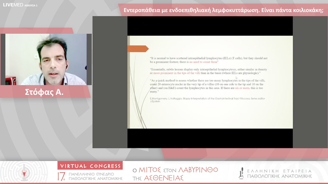 35 Στόφας Α. - Εντεροπάθεια με ενδοεπιθηλιακή λεμφοκυττάρωση. Είναι πάντα κοιλιοκάκη;